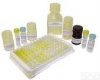  人<em>冠状</em>病毒(<em>Coronaviruses</em> IgG)Elisa<em>试剂盒</em>