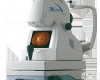  <em>日本</em>拓<em>普康</em>无<em>散瞳</em>眼底照相机TRC-NW300