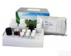  人抗<em>染色</em>体抗体ELISA<em>试剂</em>盒