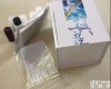  人(P-cad)P钙黏<em>蛋白</em>/<em>胎盘</em>钙黏<em>蛋白</em>ELISA<em>试剂盒</em>