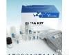 人血管<em>生成素</em>受体Tie1(ANG-R-Tie1)ELISA <em>试剂盒</em>  人血管<em>生成素</em>受体Tie1(ANG-R-Tie1)ELISA <em>试剂盒</em>供应商 