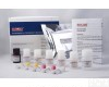  小鼠Ⅰ型前胶原羧基端肽(PⅠCP)<em>ELISA</em><em>试剂盒</em>更好更<em>优惠</em>