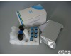  人尿<em>嘧啶</em>核苷<em>磷酸化</em>酶1(UPP1)ELISA<em>试剂盒</em>