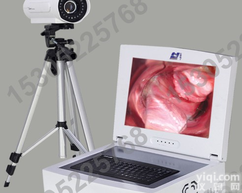 JH-3200 便携式数码电子<em>阴道</em>镜生产<em>厂家</em>