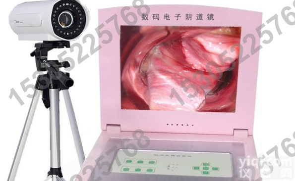 JH-5001 <em>手提</em>式数码<em>电子</em>阴道镜