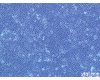 株 绿色荧光蛋白标记小鼠子宫颈癌细胞，