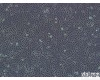 株 人低分化肺腺癌细胞，SK-LU-1