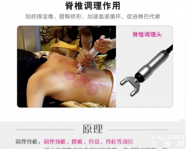 脊椎平衡理疗仪可以改善肩周炎吗