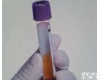 RubiconGenomics ThruPLEX Plasma ThruPLEX Plasma<em>测序</em><em>试剂盒</em>