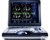 <em>美国</em>GE  Vivid i <em>美国</em>GE  Vivid i便携式彩色<em>多普勒</em>超声诊断仪G