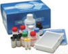 FEP<em>试剂盒</em>  人<em>游离</em>原<em>卟啉</em> ELISA<em>试剂盒</em>