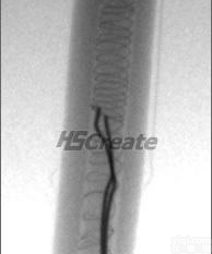  电加热管<em>检测</em>X<em>光机</em> 源于HSCreate恒胜创新<em>高清</em>电加热管<em>检测</em>X<em>光机</em>