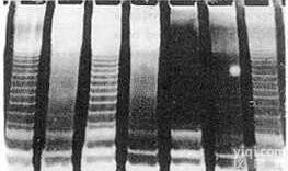 <em>美国</em><em>Sciencell</em>人间质干<em>细胞株</em>－脐带HUMSC