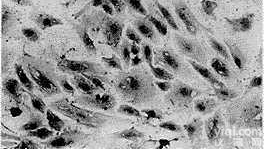 <em>美国</em><em>Sciencell</em> HUVSMC人脐静脉平滑肌<em>细胞株</em>