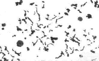 <em>金相</em><em>标样</em>：有色金属合金组织