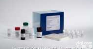 <em>41395</em>  人β氨基己糖苷酶A（β-hexosaminidase A）ELISA ...