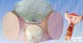 <em>SMF0122  避孕药具操作实习教学模型</em>