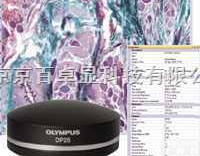 DP25  供应<em>内蒙古</em>Z佳数字CCD、供应<em>内蒙古</em>Z佳<em>奥林巴斯</em>CCD、供应<em>内蒙古</em>Z佳...