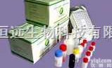 人绿脓<em>杆菌</em><em>外毒素</em>A ELISA<em>试剂盒</em>