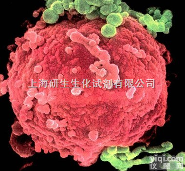 <em>Anti</em>-HGV（<em>Hepatitis</em> G vivus） ...