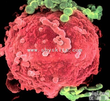 Anti-HIV <em>gp120</em>  <em>艾滋病</em>病毒<em>抗体</em>