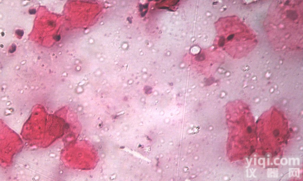 <em>胶质瘤</em>，<em>SHG</em>-44<em>细胞</em>