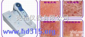 M320104  <em>皮肤</em><em>检测仪</em>|<em>皮肤</em>分析仪|<em>皮肤</em><em>测试仪</em>|<em>皮肤</em>仪
