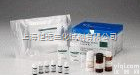 上海人MAG Ab<em>试剂盒</em> 96Ｔ/48Ｔ  人抗<em>髓鞘</em>相关糖<em>蛋白</em>抗体<em>试剂盒</em>