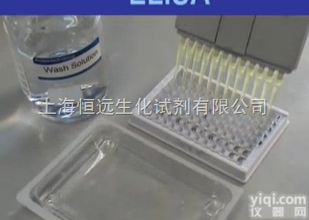 上海人CT<em>试剂盒</em>96Ｔ/48Ｔ  人沙眼<em>衣原体</em>抗体<em>试剂盒</em>