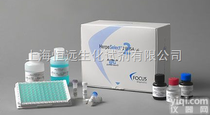 人PWM  <em>人美洲商陆素试剂盒</em>