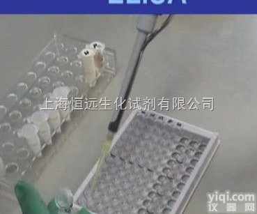 大鼠<em>Smad7</em>  大鼠<em>Smad7</em> <em>试剂盒</em>