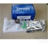 Cas号 <em>5892</em>-10-4  次碳酸铋/<em>碱式碳酸铋</em>/碳酸氧铋/碳酸铋/碳酸二氧化二铋/Bismuth...