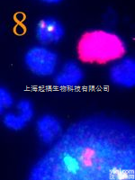 <em>产前诊断</em>探针