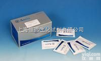 牛丙酮检测（acetone）ELISA试剂盒