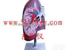 产品货号： wi78957  <em>支气管</em>右肺<em>解剖</em>模型