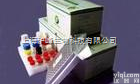 优质产品  猴乙酰乙酸检测（<em>ACAC</em>）<em>ELISA</em><em>试剂盒</em>,北京elisa<em>试剂盒</em>专卖