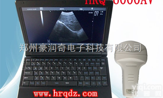 HRQ-6000AV  <em>畜牧局</em>采购专用动物B超机+动物B超测温仪+<em>畜牧局</em>