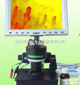 微循环<em>末梢</em>血管<em>检测仪</em>