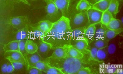 胎盘羊膜细胞总<em>蛋白质</em><em>抽提物</em>报价