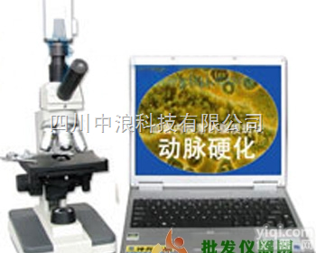 一滴<em>血检</em><em>测仪器</em>（单目）<em>电脑</em>型