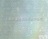 <em>细胞株</em>  脑胶质瘤细胞<em>SHG</em>-<em>44</em>