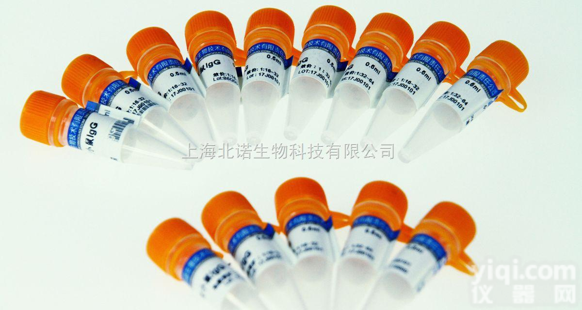 血液<em>基因组</em>DNA大量<em>提取</em><em>试剂盒</em>