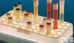 50<em>孔冻存</em>管<em>支架</em>  Thermo Scientific 50<em>孔冻存</em>管<em>支架</em>  <em>价格优惠</em>