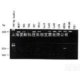 Ec109  人食管<em>癌细胞</em> Ec109  细胞株  （<em>价格优惠</em>）