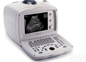 BXS06-DP-2200  全数字<em>便携式</em>超声诊断系统 经济型全数字<em>便携式</em><em>超生</em>诊断测试仪 <em>便携式</em><em>超生</em>...