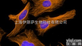 Alexa Fluor® 594）  Goat <em>polyclonal</em> <em>Secondary</em> <em>Antibody</em> ...