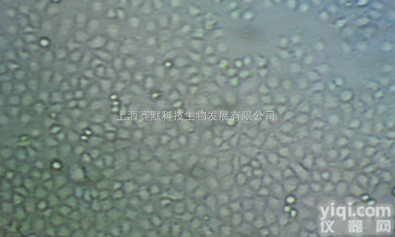 肾癌细胞