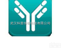 cr-1-1  HCG人<em>绒毛</em>膜促<em>性腺</em>激素配对单克隆<em>抗体</em>;人<em>绒毛</em>膜促<em>性腺</em>激素 单克隆<em>抗体</em>...