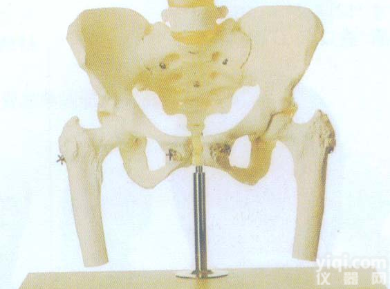 GD/A11129  <em>骨盆</em>附<em>腰椎</em>与股骨头<em>模型</em>