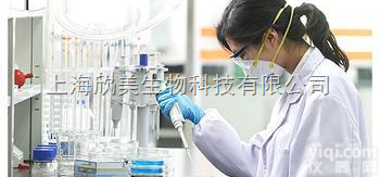 <em>伯氏</em>疏<em>螺旋体</em>PCR Kit价格，<em>伯氏</em>疏<em>螺旋体</em>PCR试剂盒